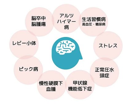 認知症になる原因は何ですか ストレスや疾患との関係などについて教えてください 介護のほんね