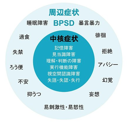 認知症の症状とは 中核症状 周辺症状 家族の対応などを種類別に紹介 介護のほんね