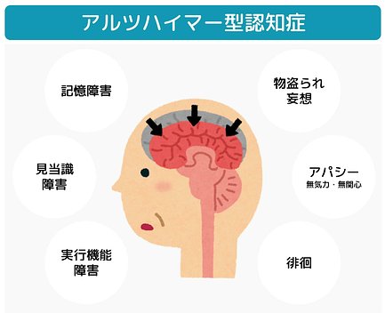 専門医師監修 認知症の種類について 中核症状 周辺症状 原因 治療方法も一緒にご紹介 介護のほんね