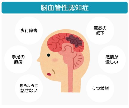 専門医師監修 認知症の種類について 中核症状 周辺症状 原因 治療方法も一緒にご紹介 介護のほんね