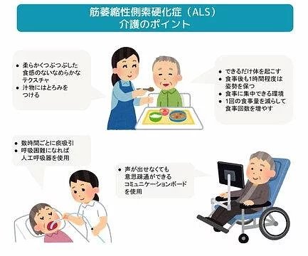 医師監修 筋萎縮性側索硬化症 Als とは 治療法や初期症状 介護のポイントなど 介護のほんね