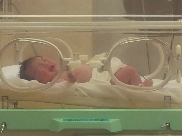 10人に1人が低出生体重児の今 小さな体で生まれた赤ちゃんの未来とは 介護のほんねニュース 介護のほんね